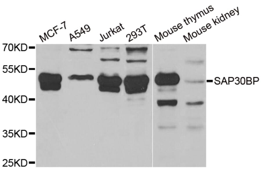 Western Blot - Anti-SAP30BP Antibody (A6460) - Antibodies.com