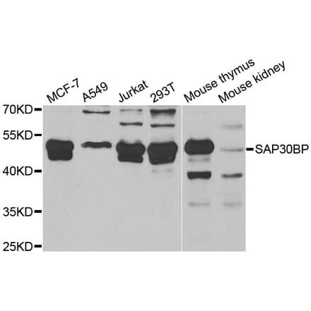 Western Blot - Anti-SAP30BP Antibody (A15237) - Antibodies.com