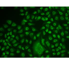 Immunofluorescence - Anti-TFPT Antibody (A15238) - Antibodies.com