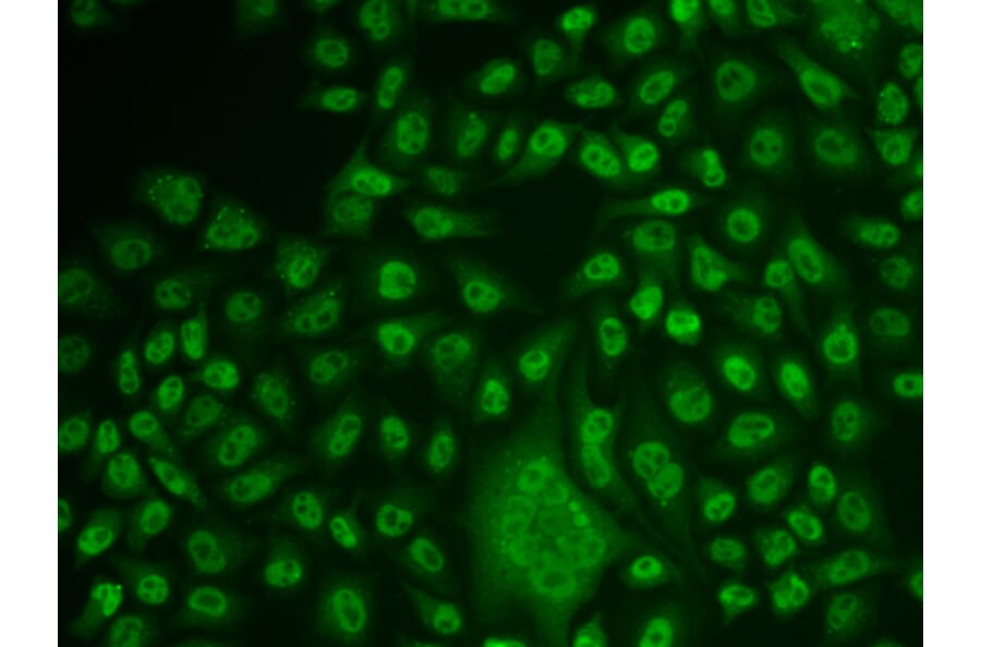 Immunofluorescence - Anti-TFPT Antibody (A15238) - Antibodies.com