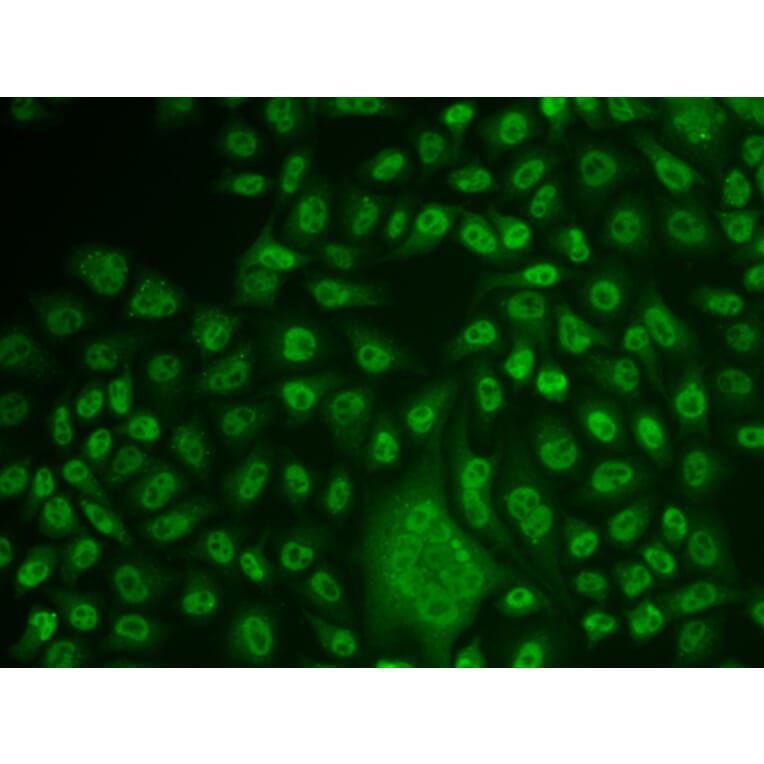 Immunofluorescence - Anti-TFPT Antibody (A15238) - Antibodies.com