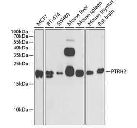 Western Blot - Anti-BIT1 Antibody (A15239) - Antibodies.com