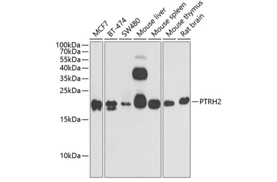 Western Blot - Anti-BIT1 Antibody (A15239) - Antibodies.com