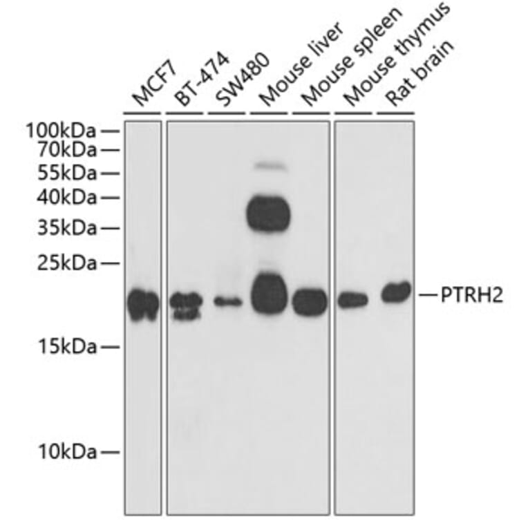 Western Blot - Anti-BIT1 Antibody (A15239) - Antibodies.com