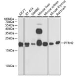 Western Blot - Anti-BIT1 Antibody (A15239) - Antibodies.com