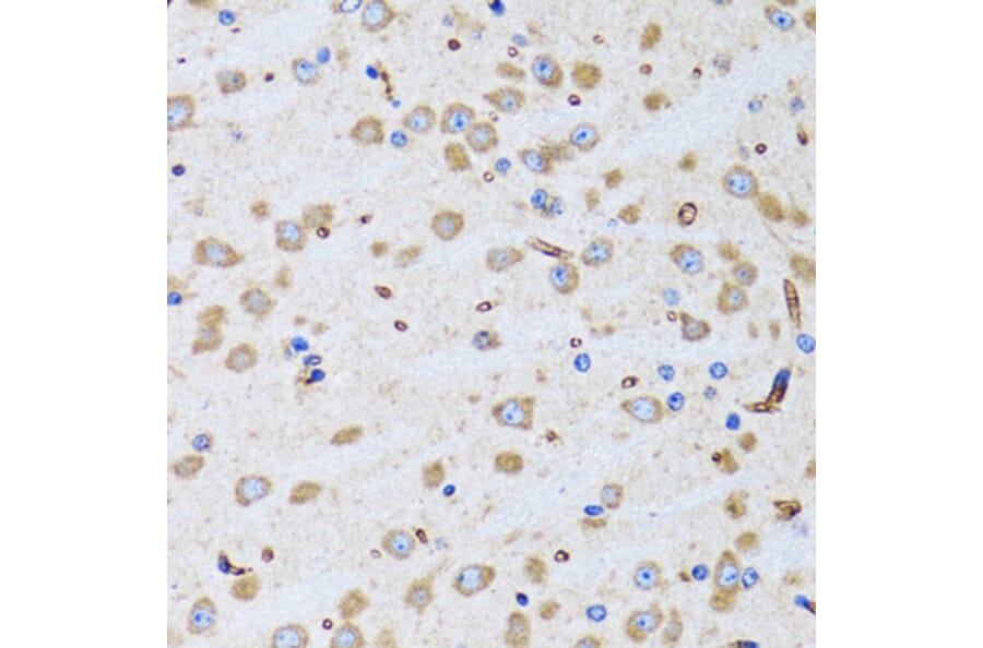 Immunohistochemistry - Anti-BIT1 Antibody (A15239) - Antibodies.com
