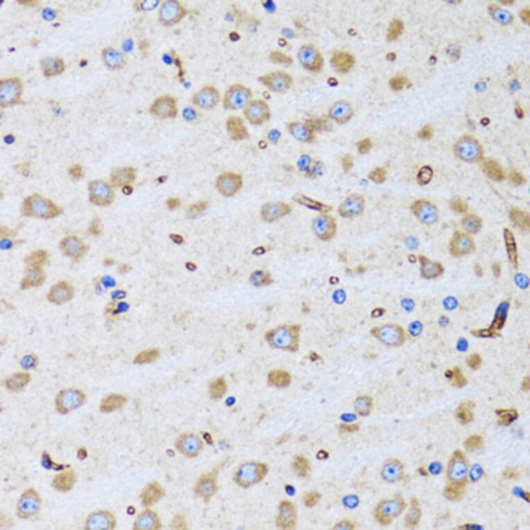 Immunohistochemistry - Anti-BIT1 Antibody (A15239) - Antibodies.com