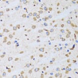 Immunohistochemistry - Anti-BIT1 Antibody (A15239) - Antibodies.com