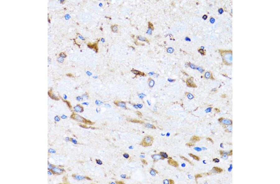 Immunohistochemistry - Anti-BIT1 Antibody (A15239) - Antibodies.com