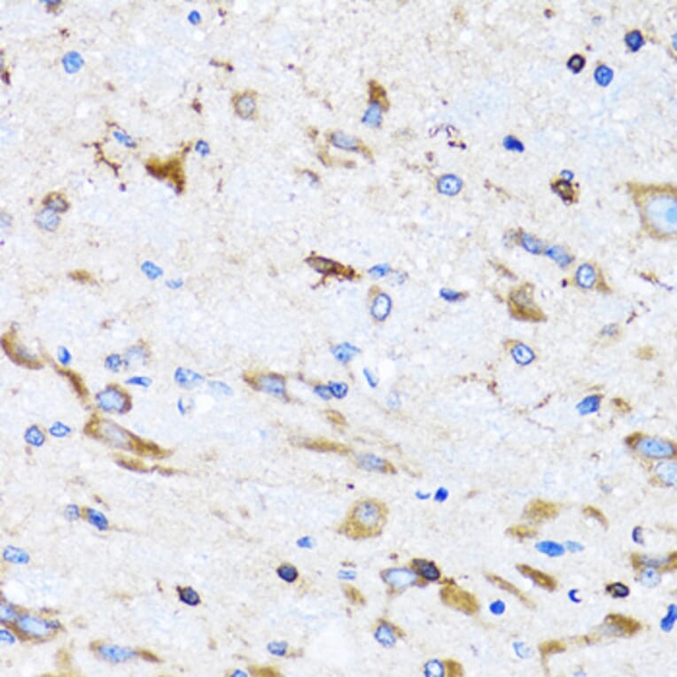 Immunohistochemistry - Anti-BIT1 Antibody (A15239) - Antibodies.com