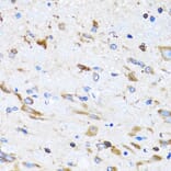 Immunohistochemistry - Anti-BIT1 Antibody (A15239) - Antibodies.com