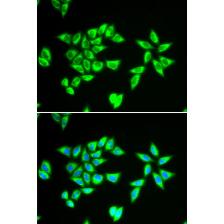 Immunofluorescence - Anti-BIT1 Antibody (A15239) - Antibodies.com