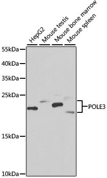 Western blot analysis of extracts of various cell lines, using Anti-POLE3 Antibody (A6469) at 1:1,000 dilution.
Secondary antibody: Goat Anti-Rabbit IgG (H+L) (HRP) (AS014) at 1:10,000 dilution.
Lysates / proteins: 25µg per lane.
Blocking buffer: 3% non-fat dry milk in TBST.
Detection: ECL Enhanced Kit (RM00021).
Exposure time: 90s.