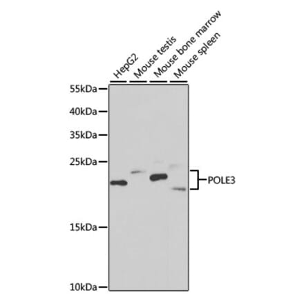 Western Blot - Anti-CHRAC-17 Antibody (A15240) - Antibodies.com