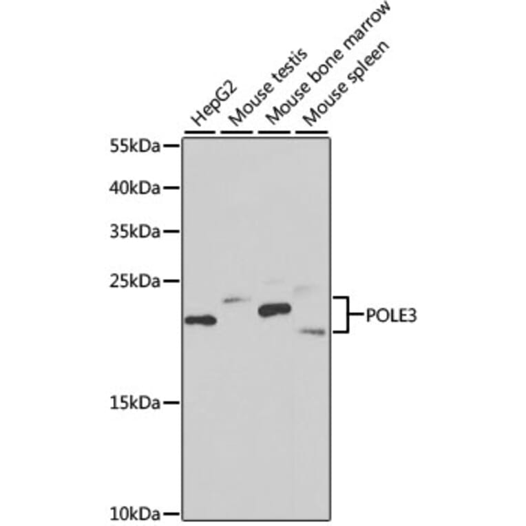 Western Blot - Anti-CHRAC-17 Antibody (A15240) - Antibodies.com
