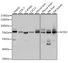 Western Blot - Anti-ACSS2 Antibody (A15241) - Antibodies.com