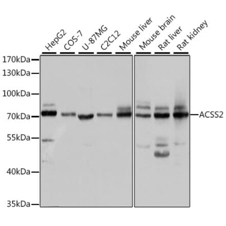 Western Blot - Anti-ACSS2 Antibody (A15241) - Antibodies.com