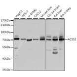 Western Blot - Anti-ACSS2 Antibody (A15241) - Antibodies.com