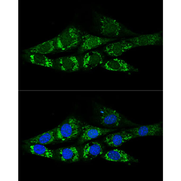 Immunofluorescence - Anti-ACSS2 Antibody (A15241) - Antibodies.com