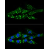 Immunofluorescence - Anti-ACSS2 Antibody (A15241) - Antibodies.com