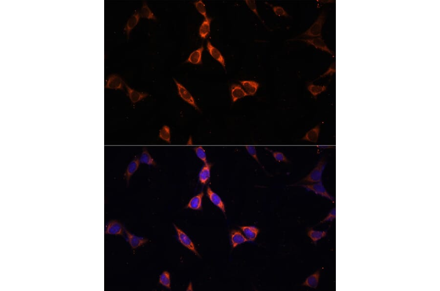 Immunofluorescence - Anti-ACSS2 Antibody (A15241) - Antibodies.com