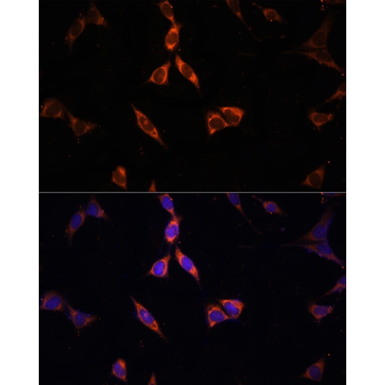 Immunofluorescence - Anti-ACSS2 Antibody (A15241) - Antibodies.com