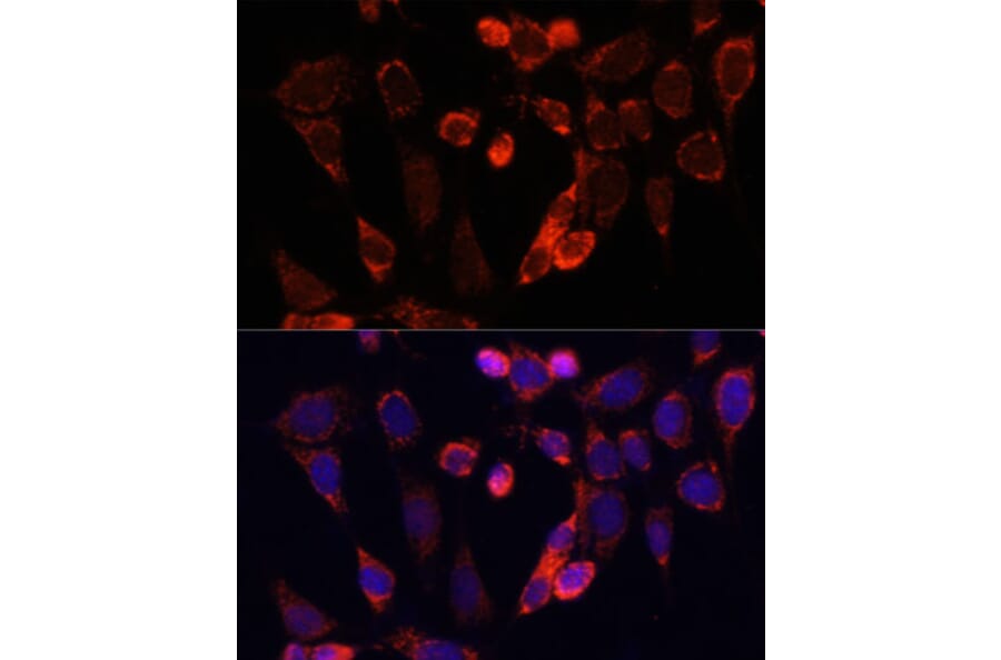 Anti-ACSS2 Antibody (A15241) | Antibodies.com