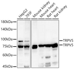 Western Blot - Anti-TRPV5 Antibody (A15242) - Antibodies.com