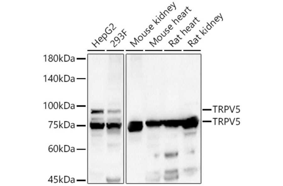 Western Blot - Anti-TRPV5 Antibody (A15242) - Antibodies.com