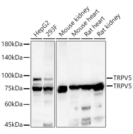 Western Blot - Anti-TRPV5 Antibody (A15242) - Antibodies.com