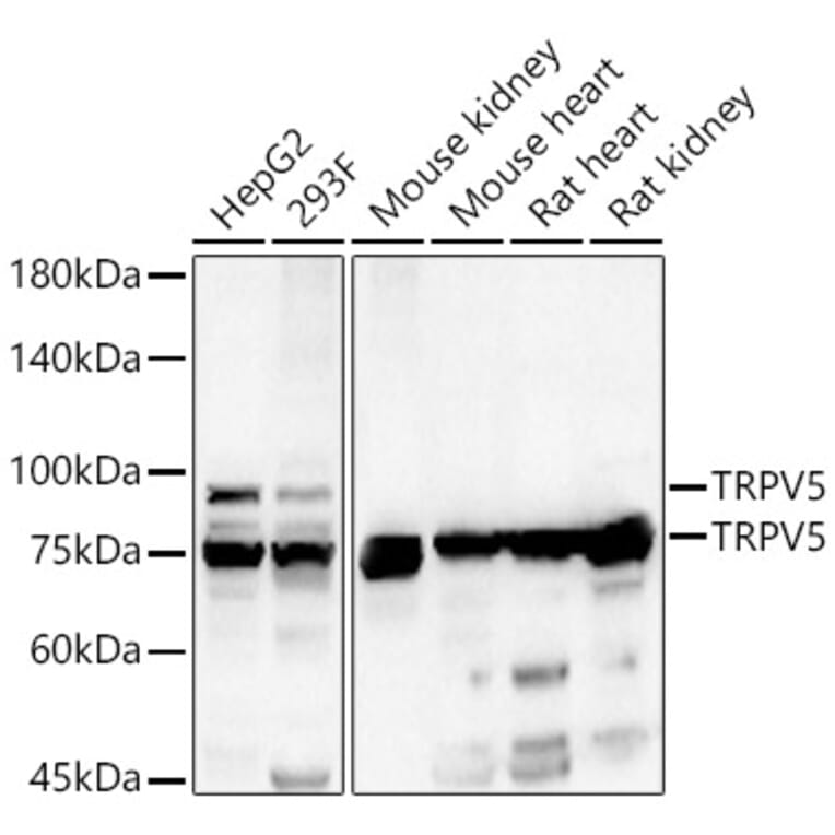 Western Blot - Anti-TRPV5 Antibody (A15242) - Antibodies.com