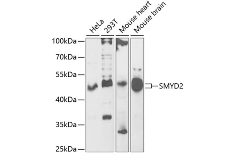 Western Blot - Anti-KMT3C/SMYD2 Antibody (A15243) - Antibodies.com
