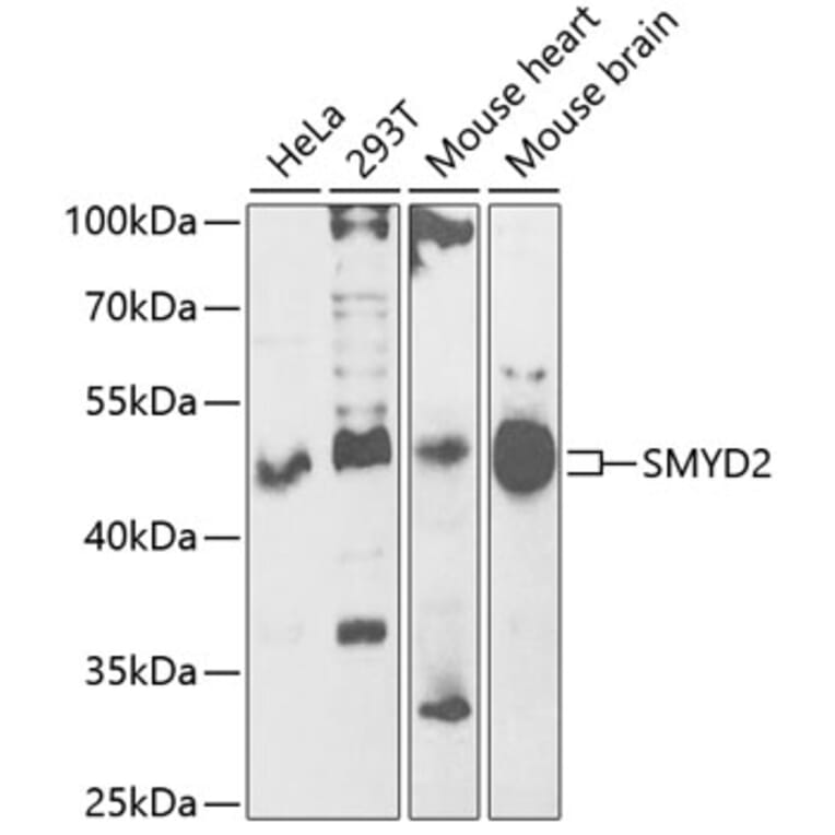 Western Blot - Anti-KMT3C/SMYD2 Antibody (A15243) - Antibodies.com