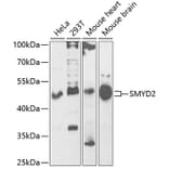 Western Blot - Anti-KMT3C/SMYD2 Antibody (A15243) - Antibodies.com