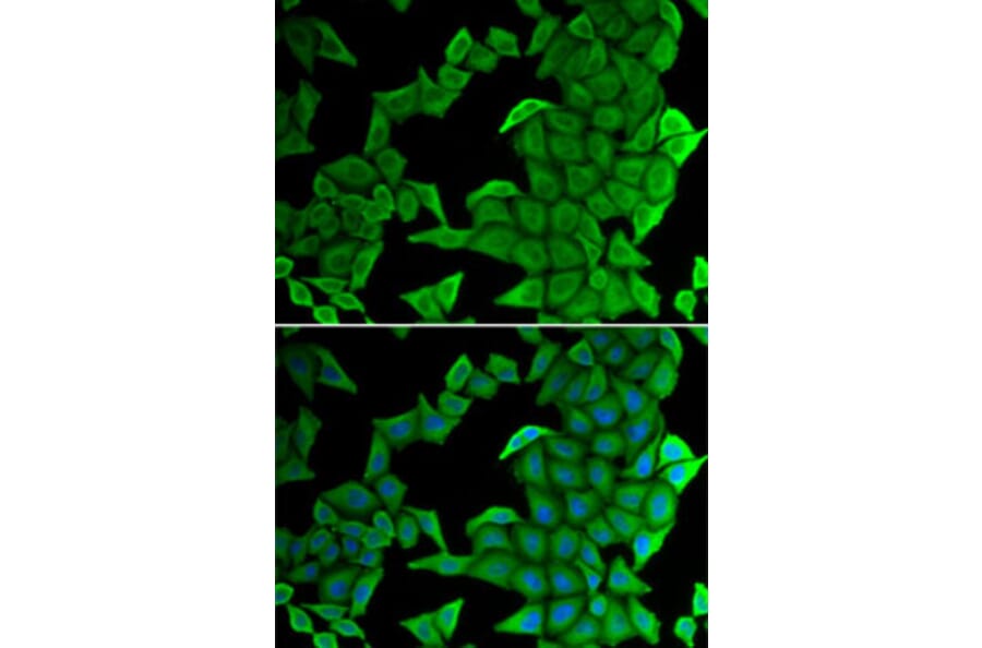 Immunofluorescence - Anti-KMT3C/SMYD2 Antibody (A15243) - Antibodies.com