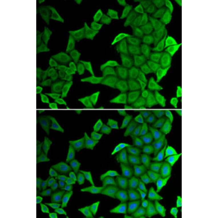 Immunofluorescence - Anti-KMT3C/SMYD2 Antibody (A15243) - Antibodies.com