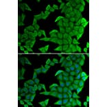 Immunofluorescence - Anti-KMT3C/SMYD2 Antibody (A15243) - Antibodies.com