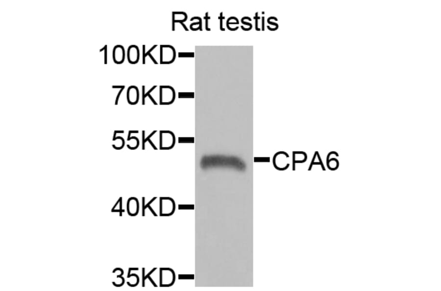 Western Blot - Anti-CPA6 Antibody (A6475) - Antibodies.com