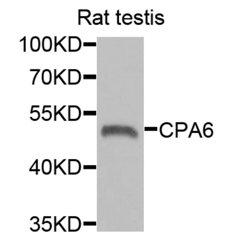 Western Blot - Anti-CPA6 Antibody (A6475) - Antibodies.com