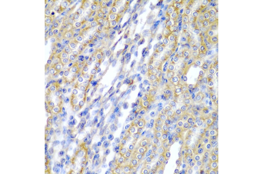 Immunohistochemistry - Anti-CYP20A1 Antibody (A6476) - Antibodies.com