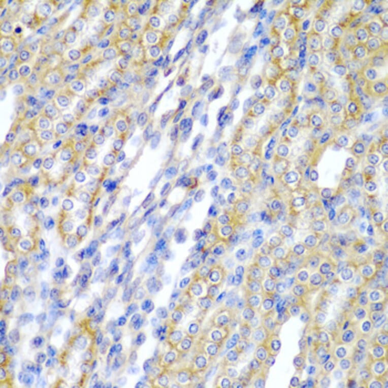 Immunohistochemistry - Anti-CYP20A1 Antibody (A6476) - Antibodies.com