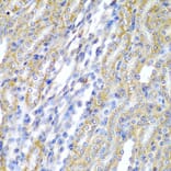 Immunohistochemistry - Anti-CYP20A1 Antibody (A6476) - Antibodies.com