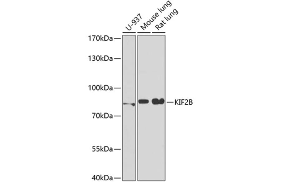 Western Blot - Anti-KIF2B Antibody (A15246) - Antibodies.com