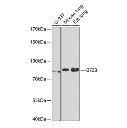 Western Blot - Anti-KIF2B Antibody (A15246) - Antibodies.com