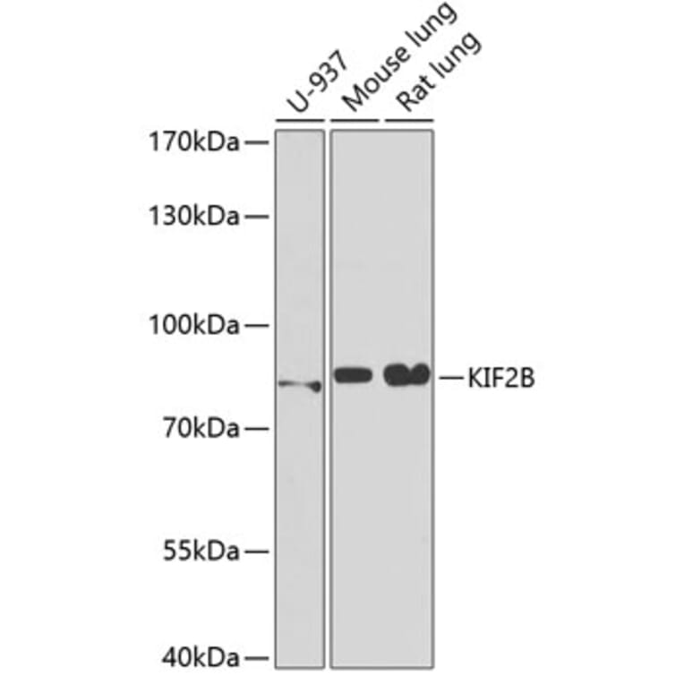 Western Blot - Anti-KIF2B Antibody (A15246) - Antibodies.com