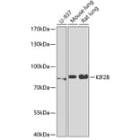 Western Blot - Anti-KIF2B Antibody (A15246) - Antibodies.com