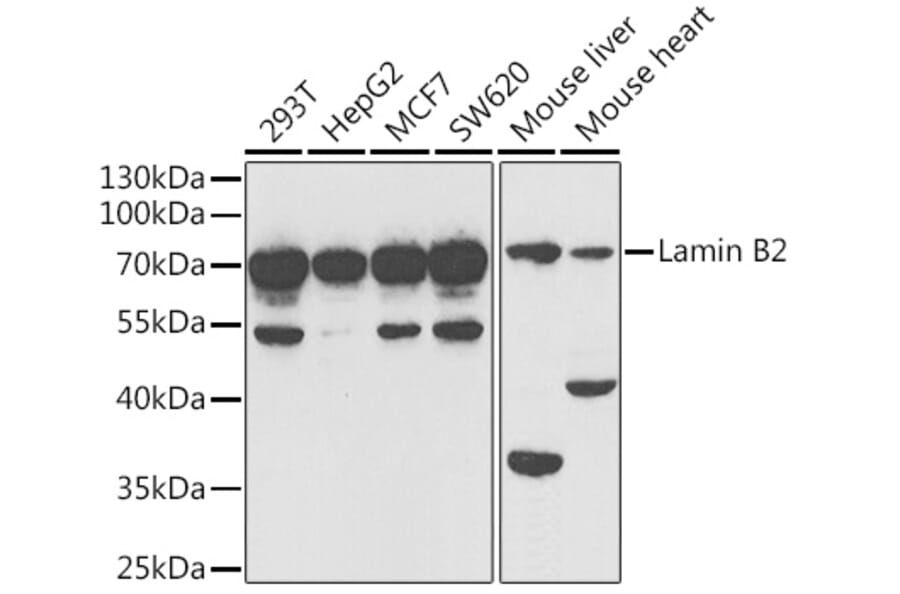 Western Blot - Anti-Lamin B2 Antibody (A15247) - Antibodies.com