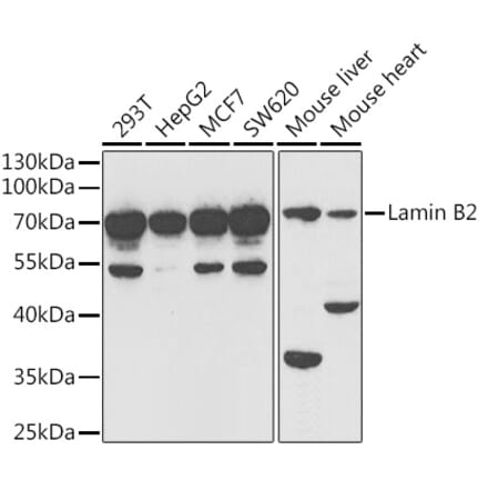 Western Blot - Anti-Lamin B2 Antibody (A15247) - Antibodies.com