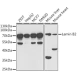 Western Blot - Anti-Lamin B2 Antibody (A15247) - Antibodies.com