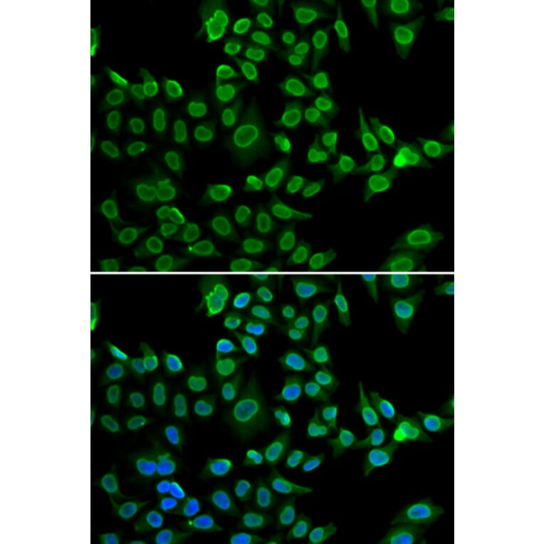 Immunofluorescence - Anti-Lamin B2 Antibody (A15247) - Antibodies.com